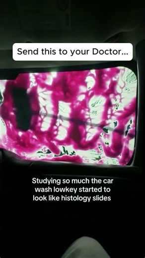 When you med student way too hard...