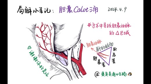 局解小笔记：胆囊Calot三角（红薯每日更新：爱臭美滴小企鹅）