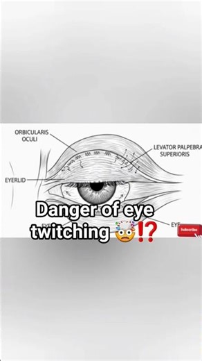 Dangers of eye twitching🤯