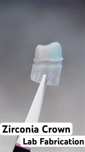 Zirconia Crown Lab Fabrication بنانے کا طریقہ #viral #highlights #dentist