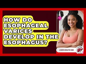 How Do Esophageal Varices Develop In The Esophagus? - Liver Health Hub