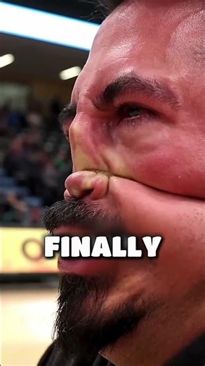 Would you survive this nose tug-of-war?