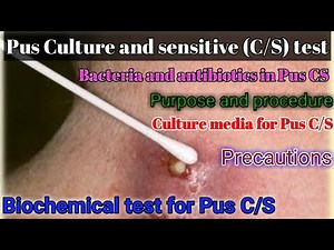 Pus Culture and Sensitivity (C/S) test: full explained