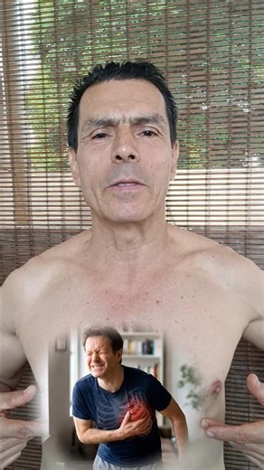 How to Reduce Intercostal Nerve Pain at Home #foryou #viral #health