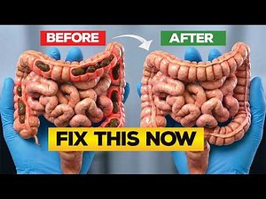 How to Cure Constipation Permanently | 10 Scientific Ways