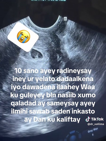 Computer hoose ee minka iyi ugxaanta waa lacag la’aan sidoo kale baaritanka guudka waa free