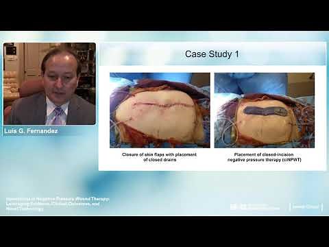 Innovations in Negative Pressure Wound Therapy