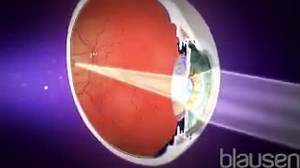 'The Complete Blausen Human #Anatomy & #Physiology Experience': Measure and improve #student engagement and retention with expert content, industry-leading media, and quizzes built into the content itself. #LMS | At https://aptextbook.webflow.io/ Who is Blausen & History https://youtu.be/ztkZB4yC75o! : Founded in 1991, Blausen is the developer, owner, and licensor of the world's most extensive library of medical and scientific illustrations and 3D animations. ―Blausen content is currently licens