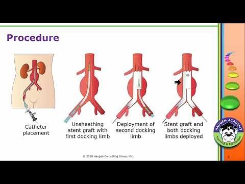 HCGTV: Webinar - Meet the new EVAR Codes