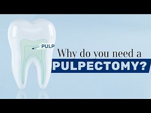 🦷 DON’T EXTRACT THAT TOOTH: A Pulpectomy Can SAVE It | Dr. Fanny Yacaman