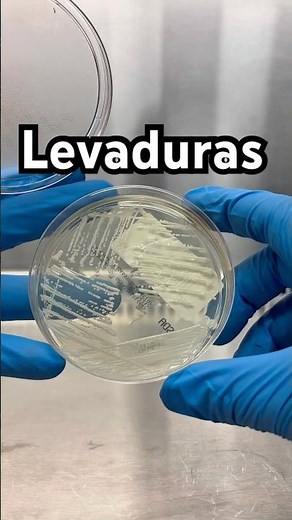 Crecimiento de levaduras 🍄‍🟫