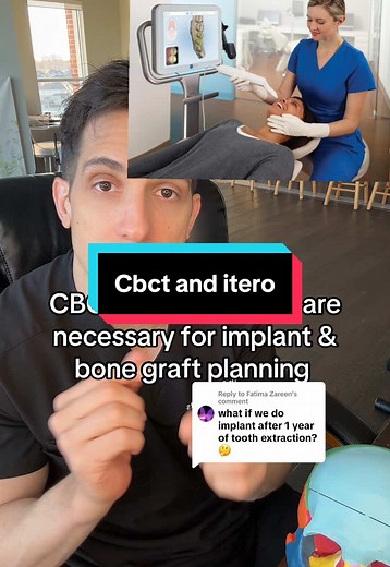 Dental Implant Planning Using CBCT and Itero Scans