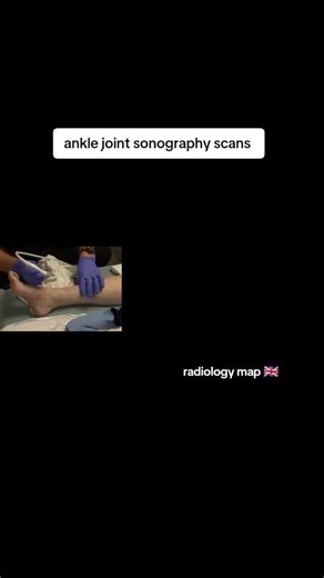 Comprehensive Guide to Ankle Joint Sonography Scans
