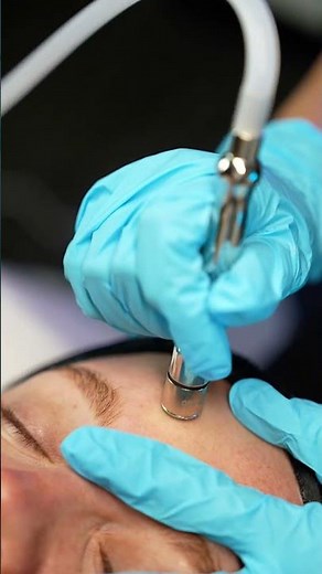 Diamond Microdermabrasion — still the #1 essential in professional skincare