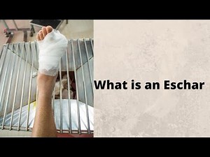 What is an Eschar