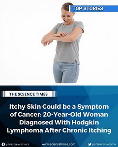 April Grierson, 20, initially thought that her washing powder caused her chronic itching. Read more here: https://bit.ly/3BvKDXz | Science Times | Facebook