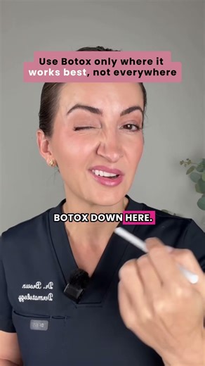 Botox mistakes that make you look older when overdone