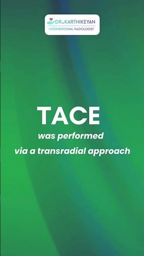 Transradial TACE Restores Transplant Eligibility in Advanced HCC | Liver Cancer Breakthrough