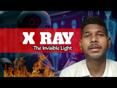 “How X-Rays Changed Medicine Forever 💀 | Hiranya Kisku”