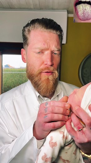 : Le muguet buccal est une infection bénigne de la bouche causée par un champignon microscopique à savoir 🌟bienvenue #baby #Reborn #muget #Hygiene #stress #prevention #maman #conseils #astuces #parents #Asavoir | Gaetan Le Rolland