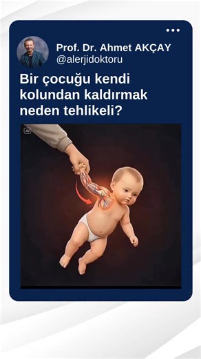 Prof. Dr. Ahmet Akçay on Instagram: "⚠️ Yetişkinlerin En Sık Yaptığı Hatalardan Biri: Çocuğu Kolundan Çekmek! Birçok yetişkin farkında olmadan çocukları elinden tutup çekiyor, kaldırıyor ya da yönlendirmeye çalışıyor. Oysa bu masum görünen hareket, küçük çocukların hassas dirsek ekleminde ani bir yaralanmaya yol açabiliyor: nursemaid’s elbow yani çekme dirseği. Sadece birkaç saniyelik bir çekme kuvveti bile, dirsek çevresindeki kemiklerin yerinden oynamasına ve çocuğun kolunu anında kullanamaz 