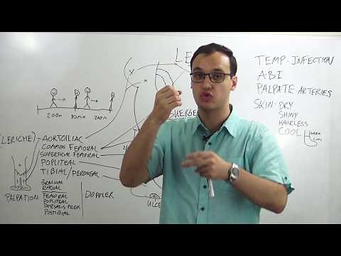 Peripheral artery disease: Symptoms