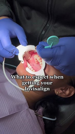 Comment some questions you may have down below about starting your invisalign😉😁 #invisalign #invisalignpartner #invisalignprovider #braces #orthodontic #orthodontics #ortho #orthodontist #treatment #viral #fyp #foryou #video #foryoupage #newyork #hudsonvalley