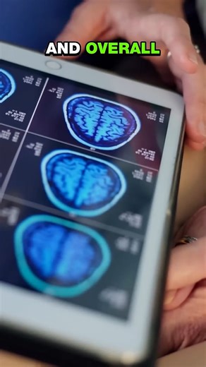 Alcohol doesn’t help you sleep — it hijacks it 🍷🧬 #SleepScience #AlcoholEffects #BrainHealth #MetabolicHealth #StayCurious | Nick Norwitz MD PhD