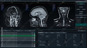 Magnetic Resonance Imaging Brain Scan Mock-up with Multiple Windows and Data. Medical Research Environment Software with MRI Results for Computer Displays and Laptop Screens.