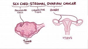 Video: Sex cord-gonadal stromal tumor - Video Explanation! | Osmosis | Osmosis