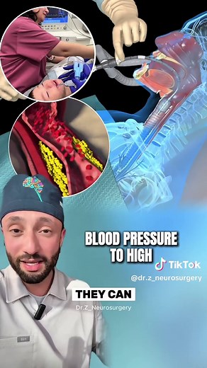 Understanding Intubation During Surgery Procedures
