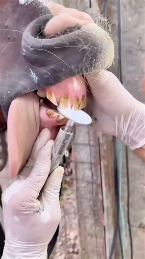 Transforming Sharp Teeth in Seconds 🦷