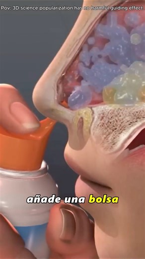 Sinus Rinse Procedure (3D Animation)#sinusrinse #sinusrelief#sinusitis #nasalsalinesolution