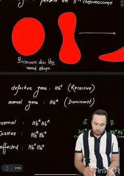 sickle cell anaemia #biology #ncert #bio