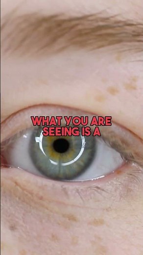 Green Eyes: Why Only 2% of Humans Have Them