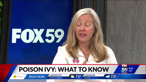 Poison Ivy: Local Pediatrician on what to know and how to treat It