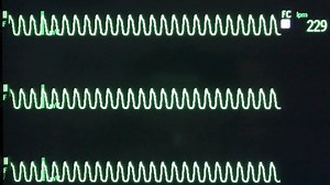 Entrénate con nosotros Curso BLS - Soporte Vital Cardiovascular Básico Curso ACLS - Soporte Vital Cardiovascular Avanzado #Bogotá todos los sábados y domingos Dirigido a personal Civil Llámanos o Escríbenos Celular/WhatsApp:( 57) 3114629821 - ( 57) 3016325526 Teléfono Directo Bogotá: (571) 7495544 Interesados pueden dejar un correoe electrónico para enviar la info detallada. | Fundación Enfermeros Militares Ciemted