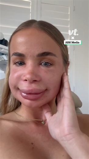 That didn't quite go as expected 😳🫣 #fail #beauty #lips | VT