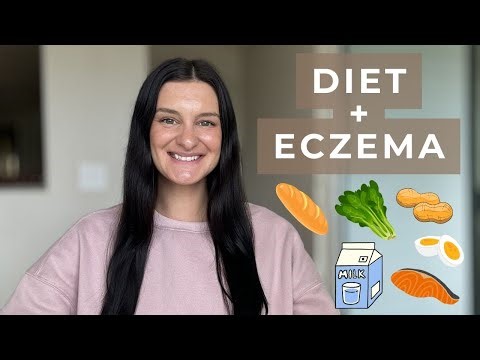 The Best Diet for Eczema | Foods to AVOID & Foods to INCREASE | ECZEMA SERIES #1