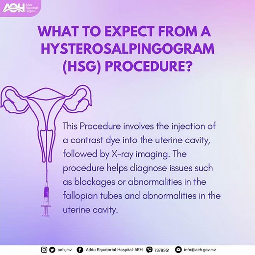 Hysterosalpingogram procedure