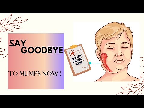 How to Cure MUMPS at Home Fast ! || 3 Excellent Home Remedies for Mumps _ NO MEDICINE