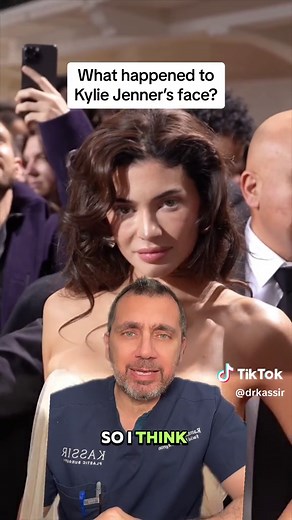 What Happened to Kylie Jenner's Face? Facial Plastic Surgeon Reveals the Truth!