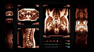 56K views · 238 reactions | WE KNOW TOXINS ARE BAD FOR US - But Did You Know New Research Shows Clearing Toxins With THIS ENZYME Can Restart the Metabolism and Assist in Shedding Stubborn Pounds And May Actually be a Major Factor in Obesity and Other Diseases including Diabetes, Heart Disease, Cancer, Alzheimer’s and More | Nanoceutical Solutions | Facebook