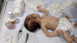 1.8K views · 64 reactions | Premature Baby Head IV Line Protocol | NICU Male Nurse Step-by-Step Care #baby #cutebaby #newbornbaby #newborn | Anoop Gautam | Facebook