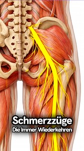 Piriformis-Syndrom“ gibt es so eigentlich nicht ( extrem selten ) Was passiert stattdessen? Der Ischiasnerv muss gleiten können. Wenn Muskeln, Faszien oder das Gewebe im Gesäß zu viel Spannung haben, verliert der Nerv diese Gleitfähigkeit💦 #physiotherapie #aufklärung #rückenschmerzen #ischias #schmerzen | Madis Dillenburg