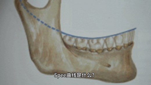 spee曲线是什么？