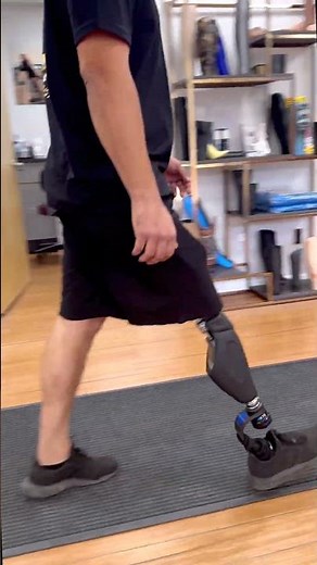 Bionic Prosthetic Knee Walking | Moe’s Above-Knee Prosthesis with Ottobock X4