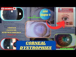 Corneal Dystrophies | Jatoi Clinical Ophthalmology | Cornea Part 17