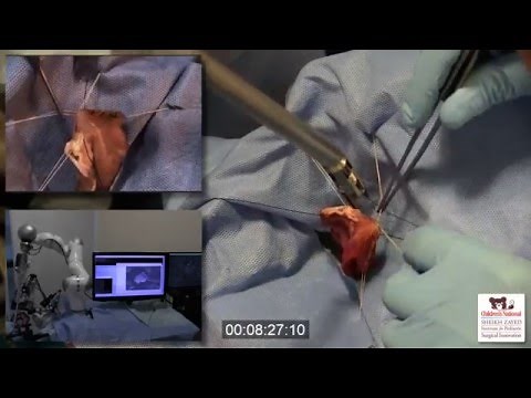 STAR Robot for “Soft Tissue” Surgery