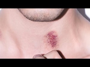 how to make a fake hickey with markers